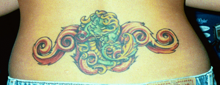 jurai.netpainful little red bumps
